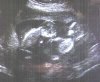 ultrasounds.jpg1234.jpg